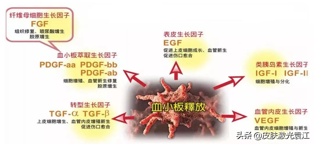 水光针怎么使皮肤好,水光针为您祛除肤质困扰