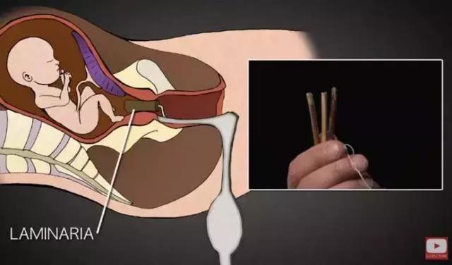 丁嘉丽明星的故事,丁嘉丽央视