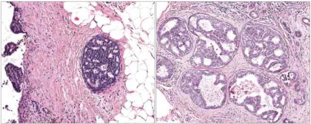 中国首款智能显微镜获批进入临床：病理诊断AI化，腾讯AILab打造