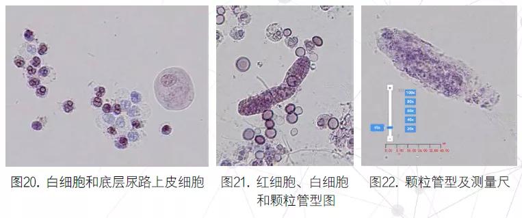 尿液有形成分分析的应用进展,尿液染色方法