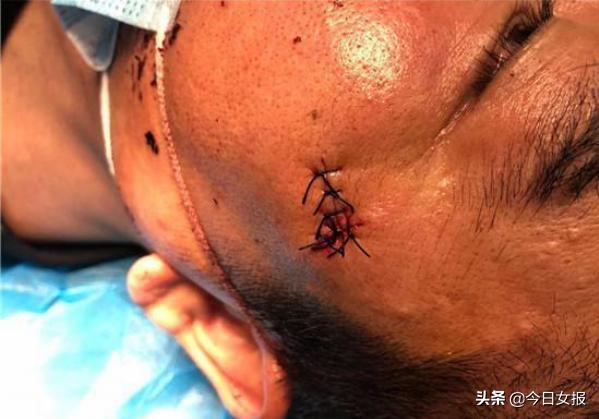 粤牌“宝马”硬闯长沙小区，业主提醒反遭“断指”！疫情期，这些冲动后果有多严重？