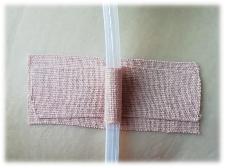 疫情期间，膀胱造瘘管居家护理怎么做？