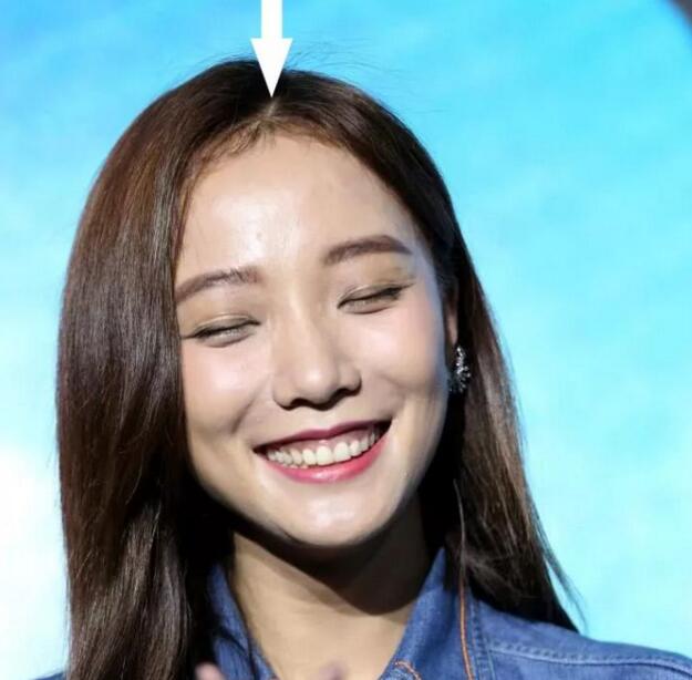 女生头发太贴头皮怎么处理,女生头发太少太软太贴头皮怎么办