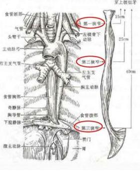 误吞枣核的小妙招,误吞了枣核怎么样有助于排出
