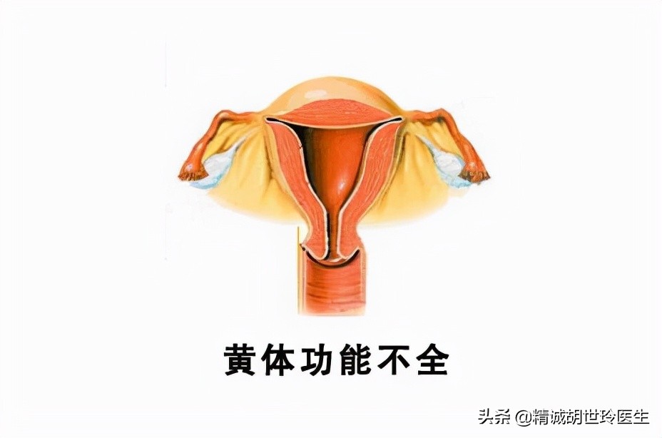 黄体功能不全会造成什么影响,黄体功能不全会导致什么病