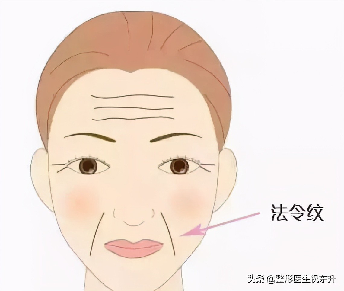 也许从一开始就错了图片,突然有了很深的法令纹