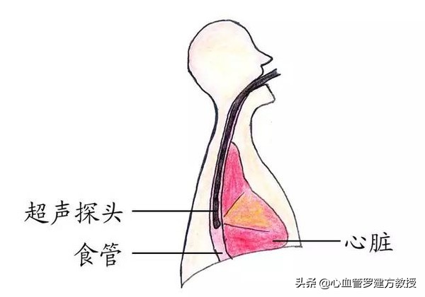 发生心律不齐，怎么样才能恢复正常？#原创首发##青云计划#
