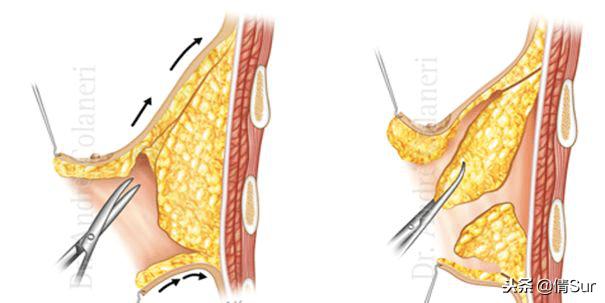 当你的胸比女朋友还大的时候,就要引起注意了……