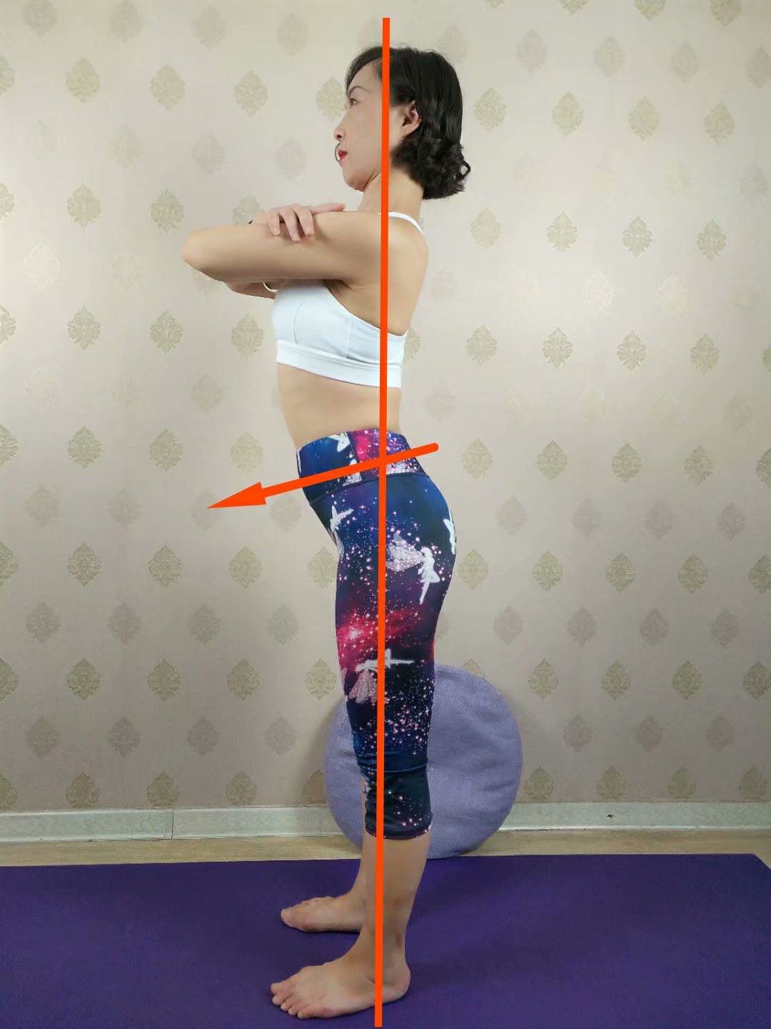 骨盆前移最快矫正法,骨盆前移复位最有效办法