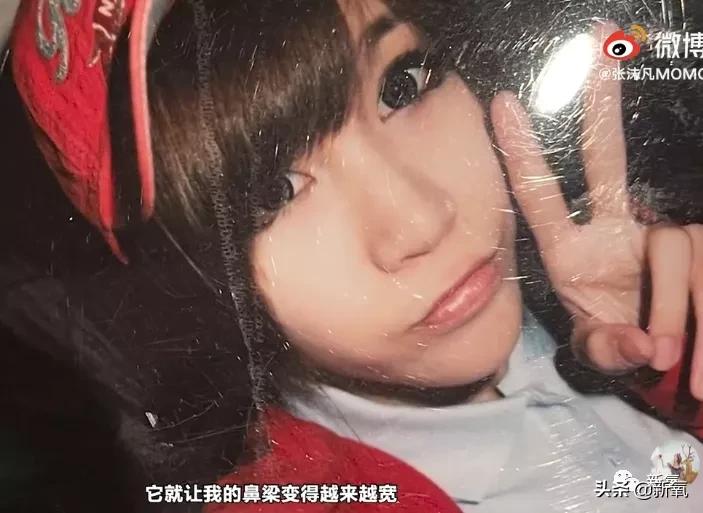 网红整鼻子整出坑,千万网红被坑