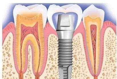 疫情期找不到口腔门诊看牙？这份居家牙病自救指南请查收