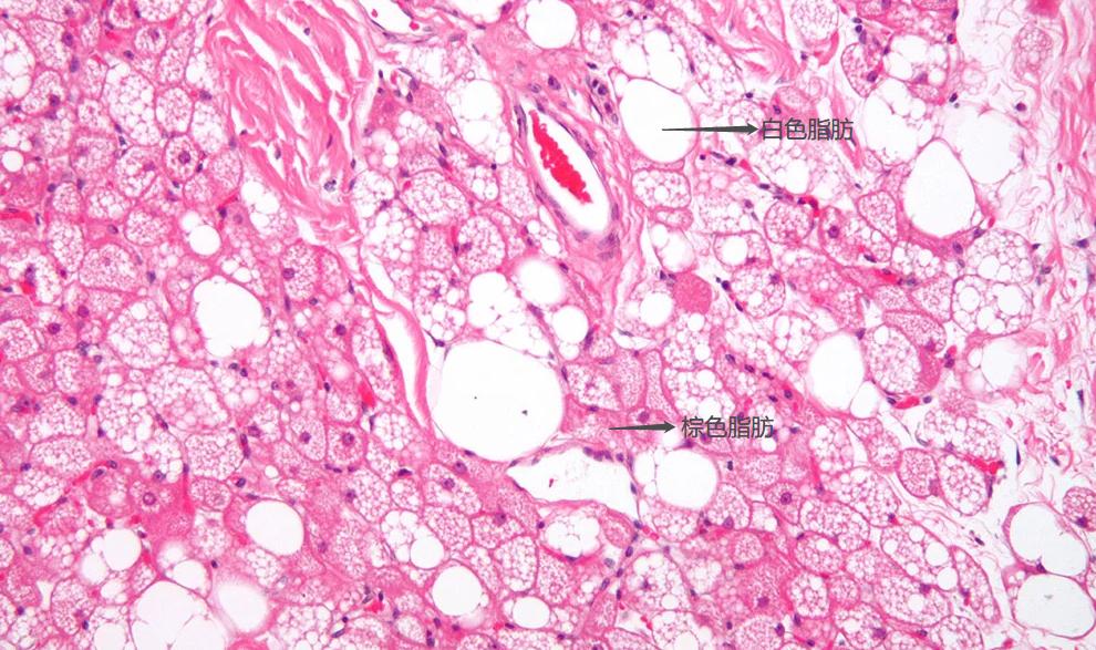冬季减肥6大误区,冬季快速有效减肥方法有哪些