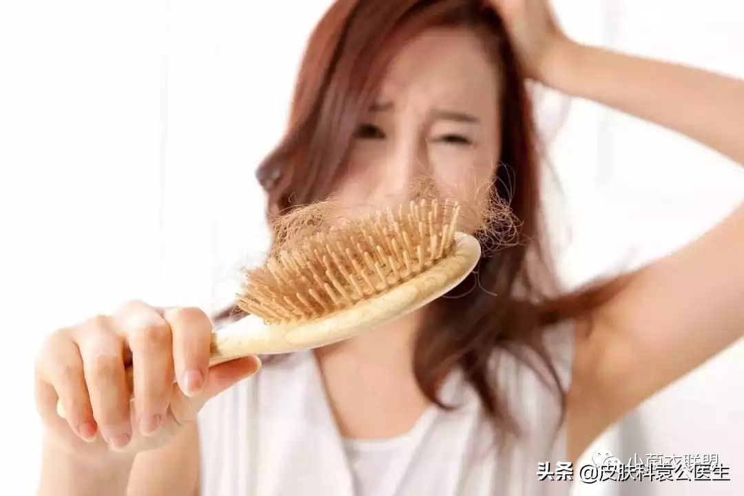 脱发严重但是头发还是很浓密,脱发头发油腻怎么办