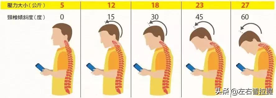 颈椎病疼痛缓解方法,颈椎病酸痛难忍怎么办
