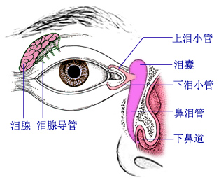 泪囊炎已做了鼻内镜手术还是流泪,泪囊炎需要做泪道插管术吗