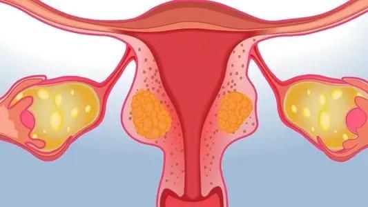 女人摘除子宫后和正常女人一样吗,女性摘掉子宫对女性有什么影响