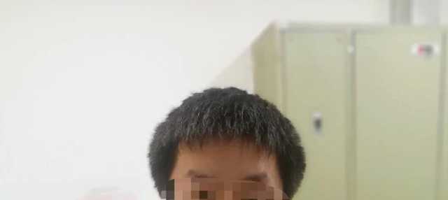 头发两侧炸毛怎么解决,男生头发两侧炸毛一招完美解决