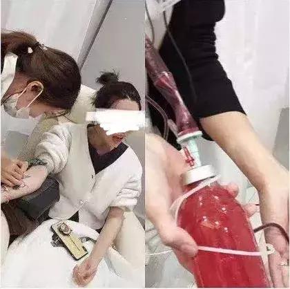 血液净化排毒有效果吗,血液净化排毒