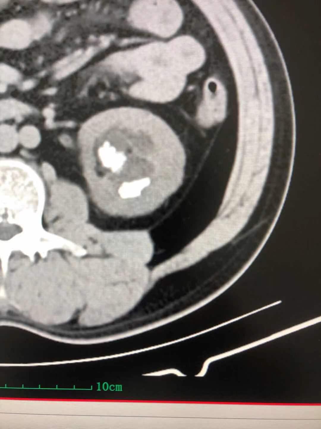 宝璋医院,利辛县宝璋医院泌尿外科怎么样