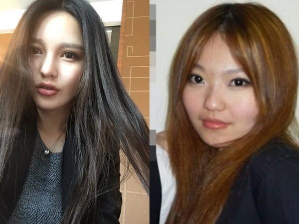 项思醒眼部整容史,项思醒整容了吗