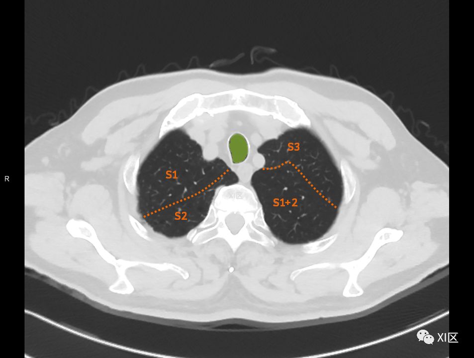 如此详细的肺部影像解剖，有点儿酷！