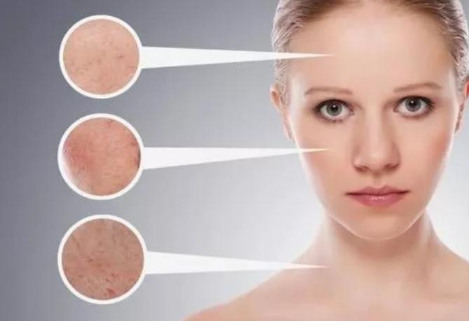 类人胶原蛋白可不可以延缓衰老,类人胶原蛋白保湿