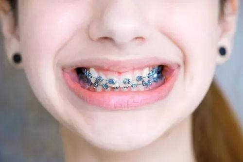 矫正牙齿垫高咬合难受怎么办,矫正牙齿第一天痛得厉害怎么办