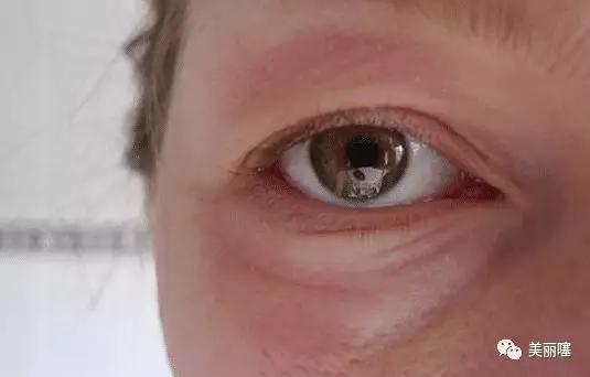 为什么说不建议女人纹“美瞳线”？美容师透露：最好看完再做决定