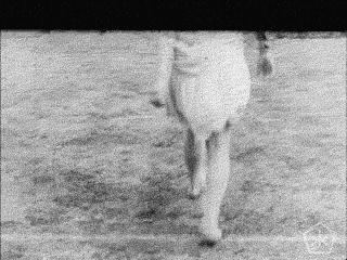 临床研究证实:围产组织间充质干细胞能改善脑瘫儿童的症状