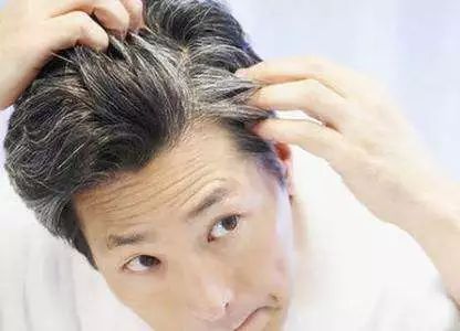 白发是如何形成的原因,白发形成
