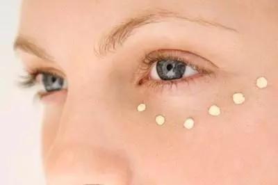 名门泽佳去眼袋产品后遗症,名门泽佳怎么去眼角脂肪粒