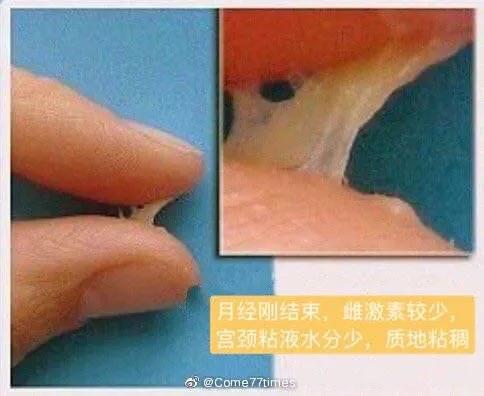 女性白带的危险信号,白带是精子形成的吗