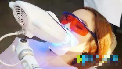 冷光牙齿美白的方法有哪些,viva冷光和皓齿冷光美白的区别