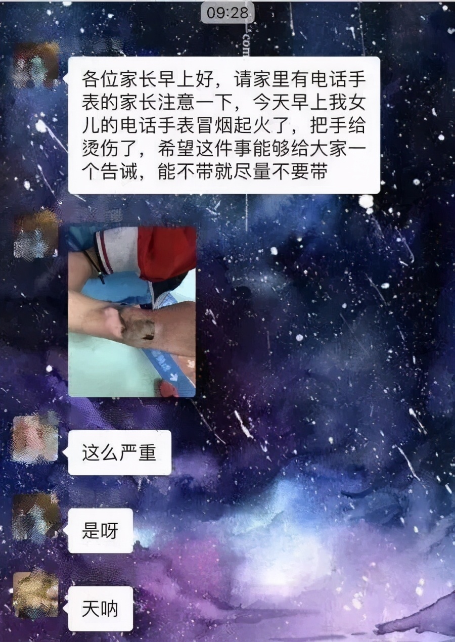 电话手表着火三岁小孩被烧伤视频,儿童电话手表突然着火的新闻视频