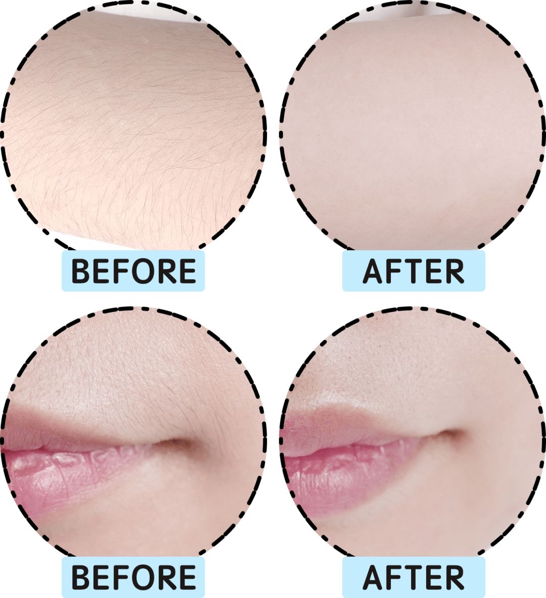 网红脱毛仪到底怎么样,脱毛仪网红都推荐什么牌子