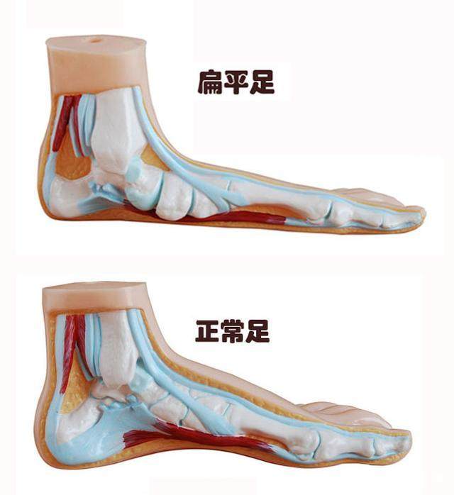 穿人字拖会影响脊椎吗,穿人字拖会导致畸形脚吗