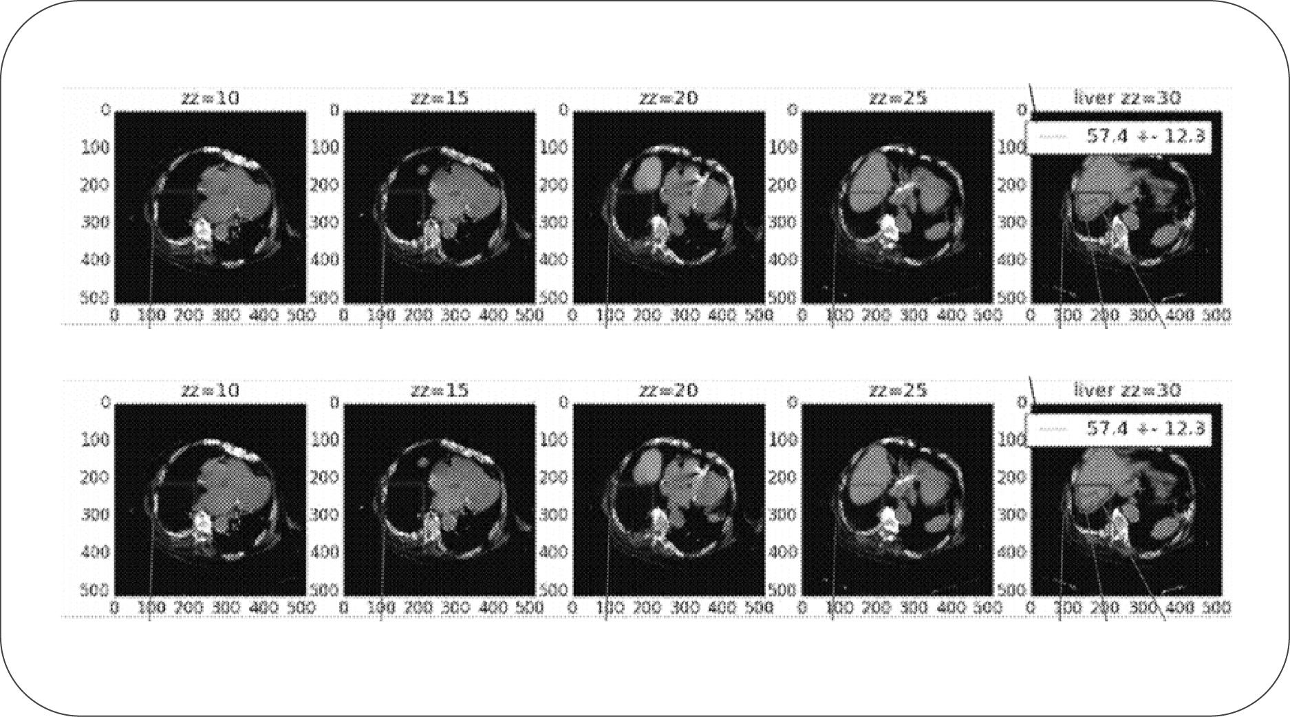 ai取代影像医生要多久,医学影像会被ai取代吗