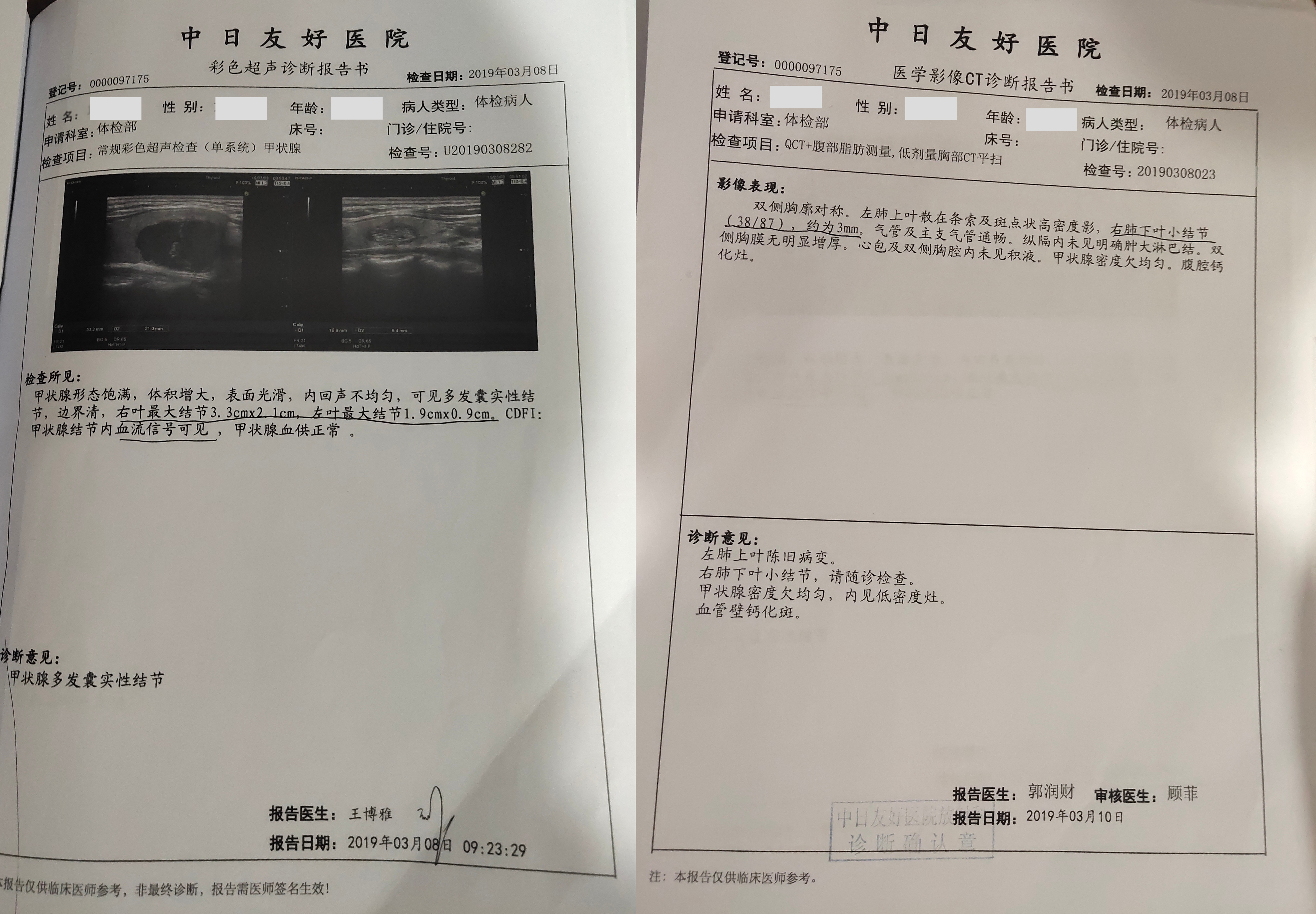 体检发现息肉结节,体检中的息肉是什么