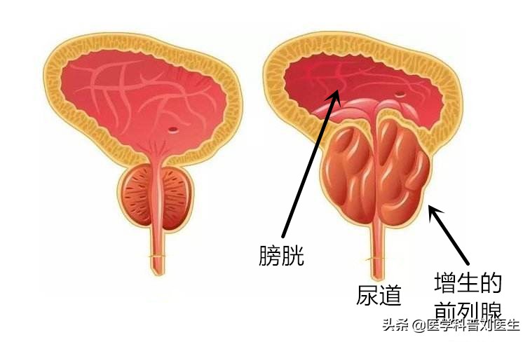如何关注男性健康,关注男性健康养生