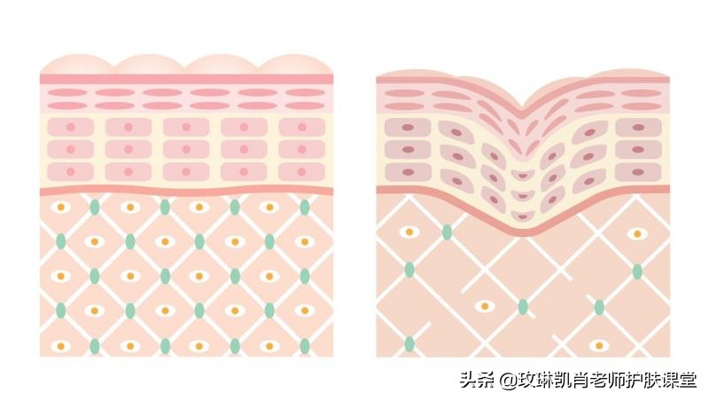 额头脸颊下巴长痘怎么调理,额头脸颊下巴反复长痘如何调理