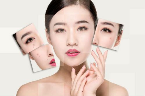 换季皮肤问题,换季皮肤问题可以自愈吗