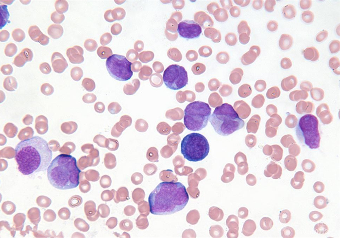 爱猫体检后发现白细胞增多就是有疾病？主因是猫压力过大