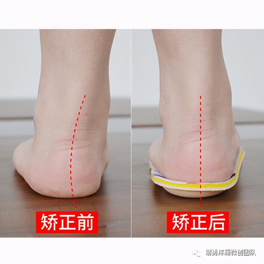 下肢不舒服查什么科,下肢不舒服做什么检查