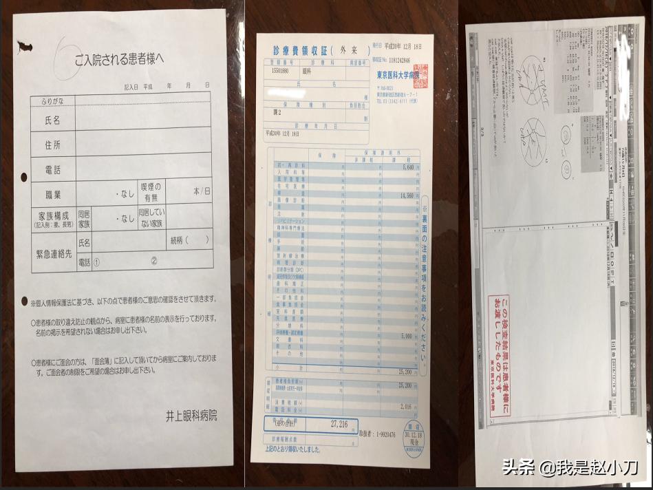 当今世界白内障手术,白内障手术为什么那么多钱