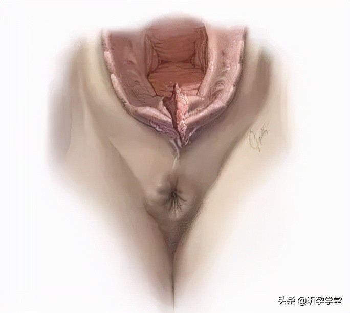 医生不建议侧切,医生不给我缝合伤口