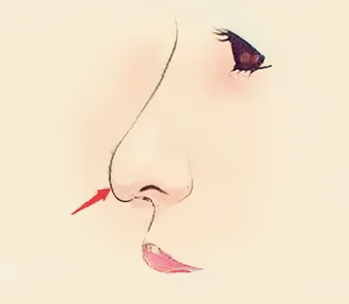 鼻子扁的人真的难看吗,鼻梁扁塌怎么补救