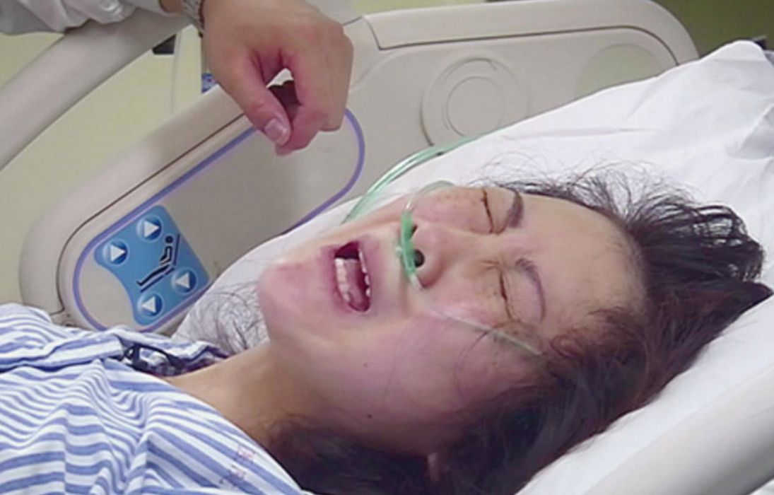 产妇生产的时候放屁的多吗,产妇生产的时候放屁吗