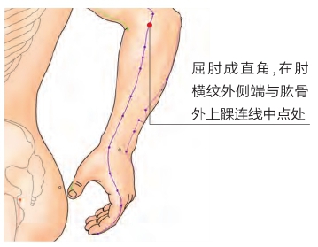 《网球肘》属于痹症的范畴，中医说3个穴位就可缓解！