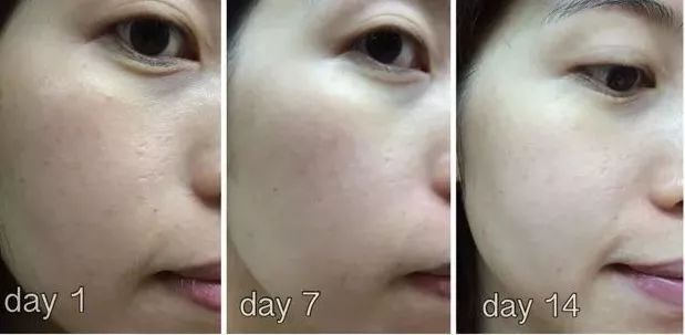 沈梦辰素颜公开惊呆了众多网友,沈梦辰颜值巅峰有多美