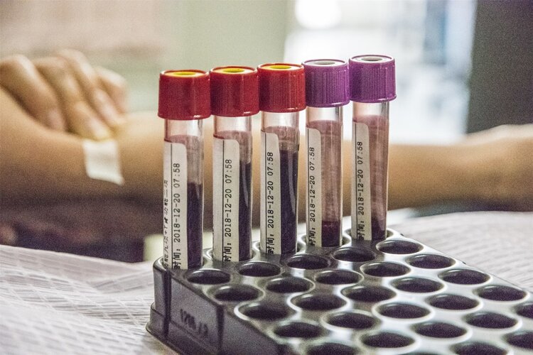 危害人类健康的病毒和病菌叫什么,肝癌和艾滋病哪种更严重